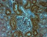 TPC1 Antibody in Immunohistochemistry (Paraffin) (IHC (P))