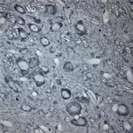 beta Tubulin Antibody in Immunohistochemistry (Paraffin) (IHC (P))