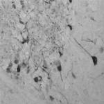 Tyrosine Hydroxylase Antibody in Immunohistochemistry (Paraffin) (IHC (P))