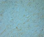 Tyrosine Hydroxylase Antibody in Immunohistochemistry (Paraffin) (IHC (P))