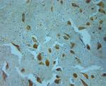 Tyrosine Hydroxylase Antibody in Immunohistochemistry (Paraffin) (IHC (P))