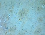 Tyrosine Hydroxylase Antibody in Immunohistochemistry (Paraffin) (IHC (P))