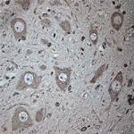 Tubulin beta Antibody in Immunohistochemistry (Paraffin) (IHC (P))