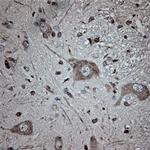 Tubulin beta Antibody in Immunohistochemistry (Paraffin) (IHC (P))