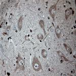 Tubulin beta Antibody in Immunohistochemistry (Paraffin) (IHC (P))