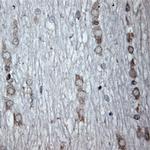 Tubulin beta Antibody in Immunohistochemistry (Paraffin) (IHC (P))