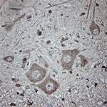 Tubulin beta Antibody in Immunohistochemistry (Paraffin) (IHC (P))