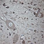 Tubulin beta Antibody in Immunohistochemistry (Paraffin) (IHC (P))