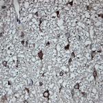 Tubulin beta Antibody in Immunohistochemistry (Paraffin) (IHC (P))