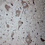 Tubulin beta Antibody in Immunohistochemistry (Paraffin) (IHC (P))