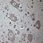 Tubulin beta Antibody in Immunohistochemistry (Paraffin) (IHC (P))