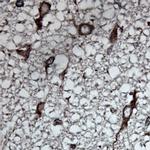 Tubulin beta Antibody in Immunohistochemistry (Paraffin) (IHC (P))