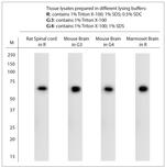 VACHT Antibody in Western Blot (WB)