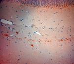 VGluT3 Antibody in Immunohistochemistry (Paraffin) (IHC (P))