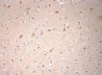 VTI1B Antibody in Immunohistochemistry (Paraffin) (IHC (P))