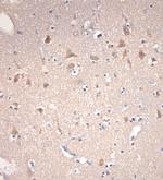 VTI1B Antibody in Immunohistochemistry (Paraffin) (IHC (P))