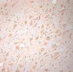 VTI1B Antibody in Immunohistochemistry (Paraffin) (IHC (P))