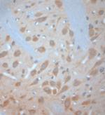 VTI1B Antibody in Immunohistochemistry (Paraffin) (IHC (P))