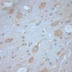 VTI1B Antibody in Immunohistochemistry (Paraffin) (IHC (P))