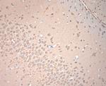 VTI1B Antibody in Immunohistochemistry (Paraffin) (IHC (P))