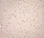 VTI1B Antibody in Immunohistochemistry (Paraffin) (IHC (P))