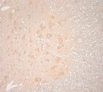 VTI1B Antibody in Immunohistochemistry (Paraffin) (IHC (P))