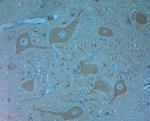 VPS34 Antibody in Immunohistochemistry (Paraffin) (IHC (P))