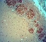 VGluT2 Antibody in Immunohistochemistry (Paraffin) (IHC (P))