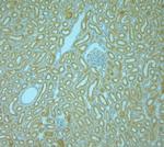 VAMP8 Antibody in Immunohistochemistry (Paraffin) (IHC (P))