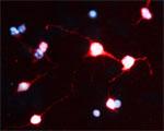 NRIF1 Antibody in Immunocytochemistry (ICC/IF)