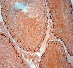 ZO1 Antibody in Immunohistochemistry (Paraffin) (IHC (P))