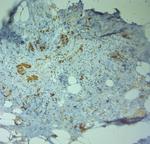 ZO2 Antibody in Immunohistochemistry (Paraffin) (IHC (P))