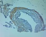 ZO2 Antibody in Immunohistochemistry (Paraffin) (IHC (P))