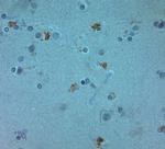 ZO2 Antibody in Immunohistochemistry (Paraffin) (IHC (P))