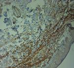 ZO2 Antibody in Immunohistochemistry (Paraffin) (IHC (P))