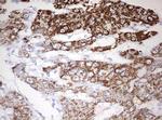 OTC Antibody in Immunohistochemistry (Paraffin) (IHC (P))