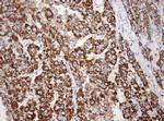 OTC Antibody in Immunohistochemistry (Paraffin) (IHC (P))