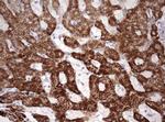 OTC Antibody in Immunohistochemistry (Paraffin) (IHC (P))