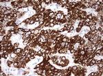 OTC Antibody in Immunohistochemistry (Paraffin) (IHC (P))