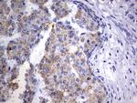 OTC Antibody in Immunohistochemistry (Paraffin) (IHC (P))