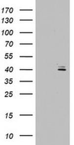 OTC Antibody in Western Blot (WB)