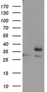 OTC Antibody in Western Blot (WB)