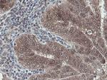 OTUB1 Antibody in Immunohistochemistry (Paraffin) (IHC (P))