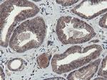 OTUB1 Antibody in Immunohistochemistry (Paraffin) (IHC (P))