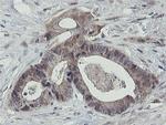 OTUB1 Antibody in Immunohistochemistry (Paraffin) (IHC (P))