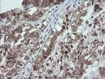 OTUB1 Antibody in Immunohistochemistry (Paraffin) (IHC (P))