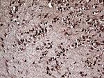 OTX2 Antibody in Immunohistochemistry (Paraffin) (IHC (P))