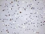 OTX2 Antibody in Immunohistochemistry (Paraffin) (IHC (P))