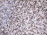 OTX2 Antibody in Immunohistochemistry (Paraffin) (IHC (P))