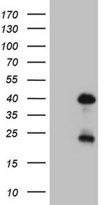 OTX2 Antibody in Western Blot (WB)